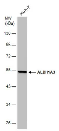 Anti-ALDH1A3 antibody [GT926] used in Western Blot (WB). GTX633822