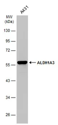 Anti-ALDH1A3 antibody [GT926] used in Western Blot (WB). GTX633822