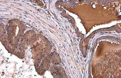 Anti-ALDH1A3 antibody [GT926] used in IHC (Paraffin sections) (IHC-P). GTX633822