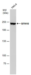 Anti-MYH10 antibody [GT324] used in Western Blot (WB). GTX634139