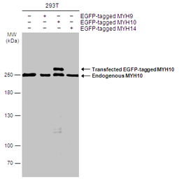 Anti-MYH10 antibody [GT324] used in Western Blot (WB). GTX634139