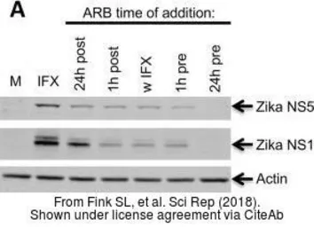 Anti-Zika virus NS1 protein antibody [GT281] used in Western Blot (WB). GTX634159