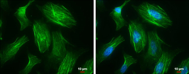 Anti-MYH10 antibody [GT246] used in Immunocytochemistry/ Immunofluorescence (ICC/IF). GTX634160
