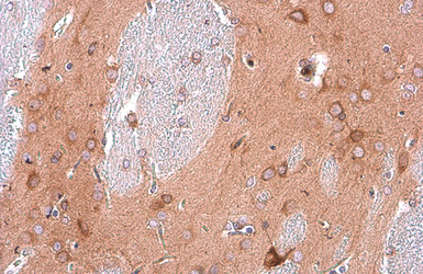 Anti-EEA1 antibody [GT10811] used in IHC (Paraffin sections) (IHC-P). GTX634169