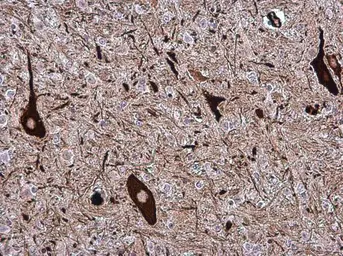 Anti-NF-H antibody [GT114] used in IHC (Paraffin sections) (IHC-P). GTX634289
