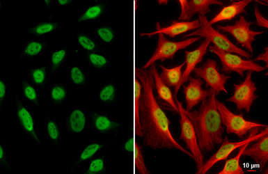 Anti-SP1 antibody [GT2574] used in Immunocytochemistry/ Immunofluorescence (ICC/IF). GTX634352