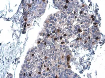 Anti-Cyclin A2 antibody [GT2547] used in IHC (Paraffin sections) (IHC-P). GTX634420