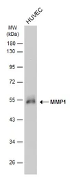 Anti-MMP1 antibody [GT2075] used in Western Blot (WB). GTX634537