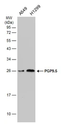 Anti-PGP9.5 antibody [GT448] used in Western Blot (WB). GTX634797