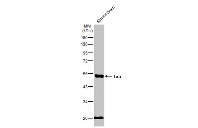 Anti-Tau antibody [GT287] used in Western Blot (WB). GTX634809