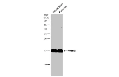 Anti-VAMP2 antibody [GT6311] used in Western Blot (WB). GTX634812