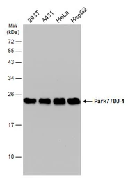 Anti-Park7 / DJ-1 antibody [GT353] used in Western Blot (WB). GTX634830
