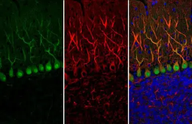 Anti-Calbindin antibody [GT386] used in IHC (Paraffin sections) (IHC-P). GTX634833