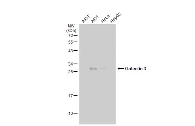 Anti-Galectin 3 antibody [GT1188] used in Western Blot (WB). GTX635156