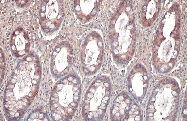 Anti-Galectin 3 antibody [GT1188] used in IHC (Paraffin sections) (IHC-P). GTX635156