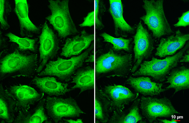 Anti-DAG1 / beta Dystroglycan antibody [GT835] used in Immunocytochemistry/ Immunofluorescence (ICC/IF). GTX635179