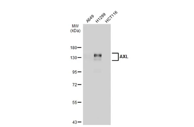 Anti-AXL antibody [GT1174] used in Western Blot (WB). GTX635210