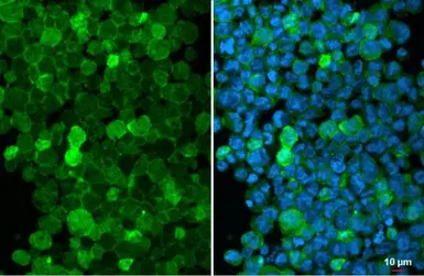 Anti-Iba1 antibody [HL22] used in Immunocytochemistry/ Immunofluorescence (ICC/IF). GTX635363