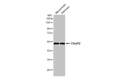 Anti-C9orf72 antibody [GT1553-RB] used in Western Blot (WB). GTX635398