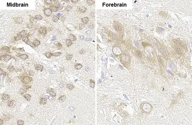 Anti-Gli1 antibody [HL247] used in IHC (Paraffin sections) (IHC-P). GTX635619
