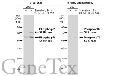 Anti-p70 S6K (phospho Thr421/Ser424) antibody [HL129] used in Western Blot (WB). GTX635621