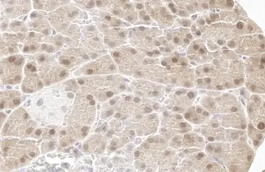 Anti-p70 S6K (phospho Thr421/Ser424) antibody [HL129] used in IHC (Paraffin sections) (IHC-P). GTX635621