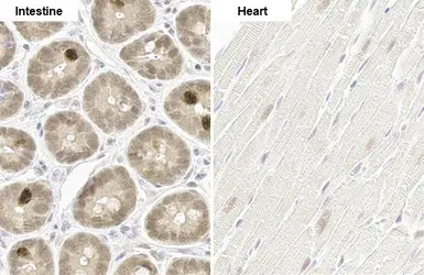 Anti-p70 S6K (phospho Thr421/Ser424) antibody [HL129] used in IHC (Paraffin sections) (IHC-P). GTX635621