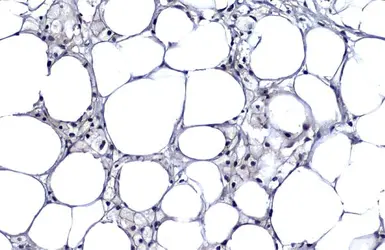 Anti-CDKN2A / p16INK4a antibody [GT888] used in IHC (Paraffin sections) (IHC-P). GTX635639