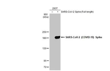 Anti-SARS-CoV-2 (COVID-19) Spike S1 antibody [HL6] used in Western Blot (WB). GTX635654