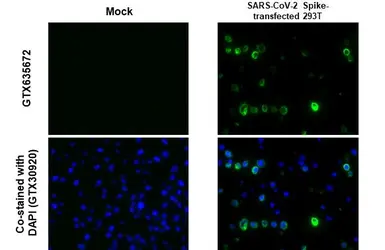 Anti-SARS-CoV-2 (COVID-19) Spike S1 antibody [HL263] used in IHC-P (cell pellet) (IHC-P (cell pellet)). GTX635672