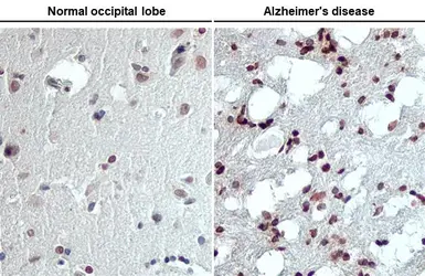 Anti-LYN (phospho Tyr397) antibody [HL122] used in IHC (Paraffin sections) (IHC-P). GTX635694