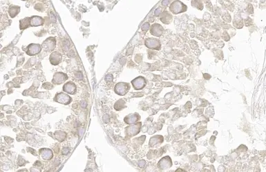 Anti-VPS35 antibody [HL1017] used in IHC (Paraffin sections) (IHC-P). GTX635821