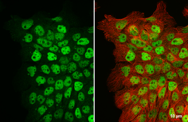Anti-p63 antibody [HL1027] used in Immunocytochemistry/ Immunofluorescence (ICC/IF). GTX635841