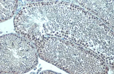 Anti-p63 antibody [HL1027] used in IHC (Paraffin sections) (IHC-P). GTX635841