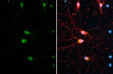 Anti-Synapsin antibody [GT965] used in Immunocytochemistry/ Immunofluorescence (ICC/IF). GTX635885