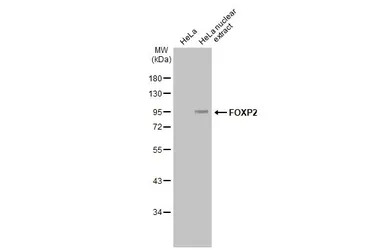 Anti-FOXP2 antibody [GT12812] used in Western Blot (WB). GTX635965