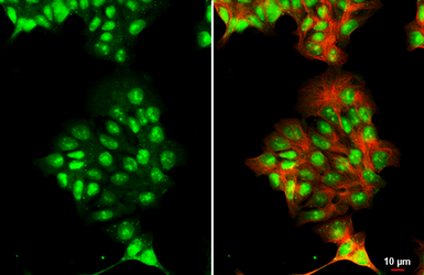 Anti-Androgen Receptor antibody [HL1049] used in Immunocytochemistry/ Immunofluorescence (ICC/IF). GTX636021