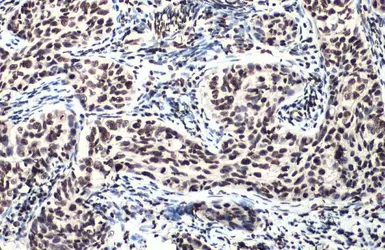 Anti-ATM (phospho Ser1981) antibody [HL1062] used in IHC (Paraffin sections) (IHC-P). GTX636086
