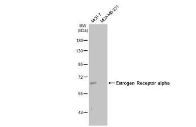Anti-Estrogen Receptor alpha antibody [HL1081] used in Western Blot (WB). GTX636202