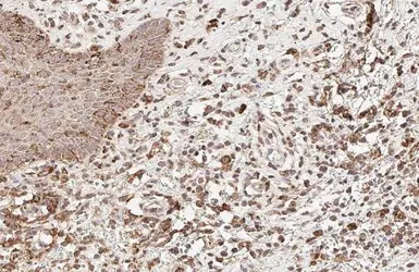 Anti-Estrogen Receptor alpha antibody [HL1081] used in IHC (Paraffin sections) (IHC-P). GTX636202