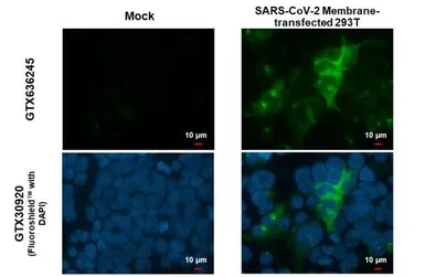 Anti-SARS-CoV-2 (COVID-19) Membrane antibody [HL1087] used in Immunocytochemistry/ Immunofluorescence (ICC/IF). GTX636245