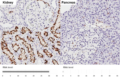 Anti-ACE2 antibody [HL1092] used in IHC (Paraffin sections) (IHC-P). GTX636265