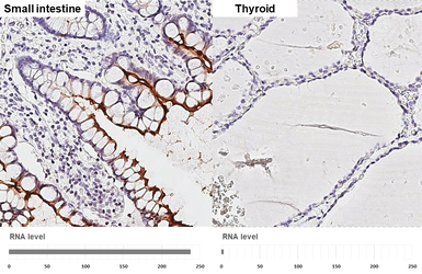 Anti-ACE2 antibody [HL1092] used in IHC (Paraffin sections) (IHC-P). GTX636265