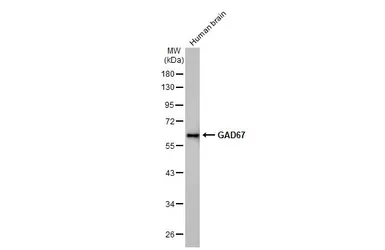 Anti-GAD67 antibody [HL1095] used in Western Blot (WB). GTX636279