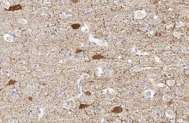 Anti-GAD67 antibody [HL1096] used in IHC (Paraffin sections) (IHC-P). GTX636280