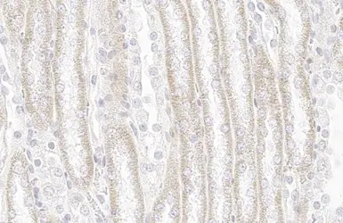 Anti-SDHA antibody [HL1117] used in IHC (Paraffin sections) (IHC-P). GTX636335