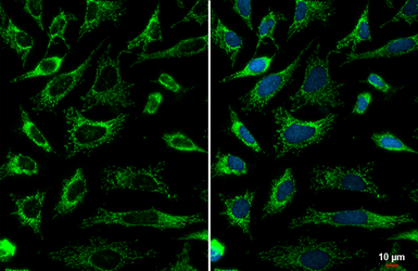 Anti-SDHA antibody [HL1117] used in Immunocytochemistry/ Immunofluorescence (ICC/IF). GTX636335