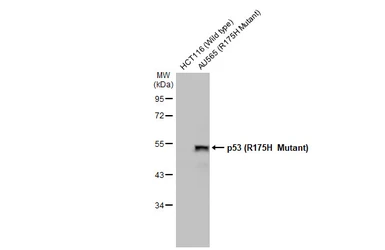 Anti-p53 (R175H Mutant) antibody [HL1129] used in Western Blot (WB). GTX636395