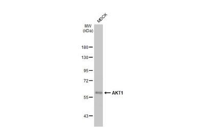 Anti-AKT1 antibody [HL1142] used in Western Blot (WB). GTX636413
