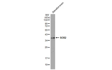 Anti-SOX2 antibody [HL1192] used in Western Blot (WB). GTX636504